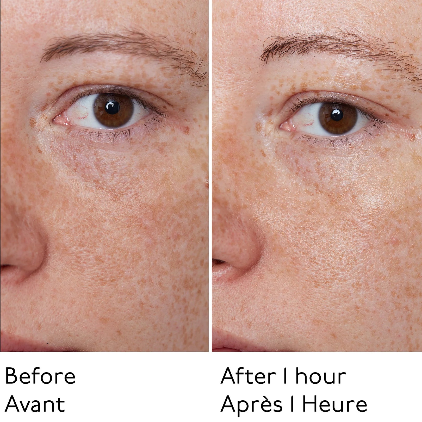 Hyaluronic Global Face Cream - Crema Viso Idratante