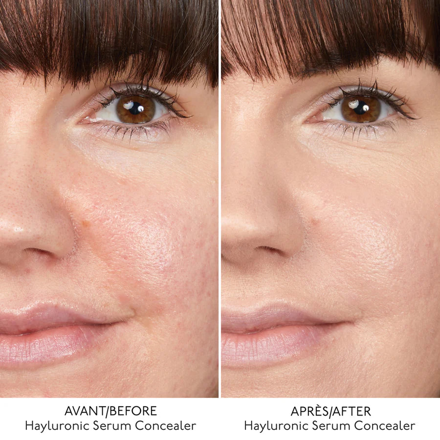 Hyaluronic Serum Concealer - Correttore idratante