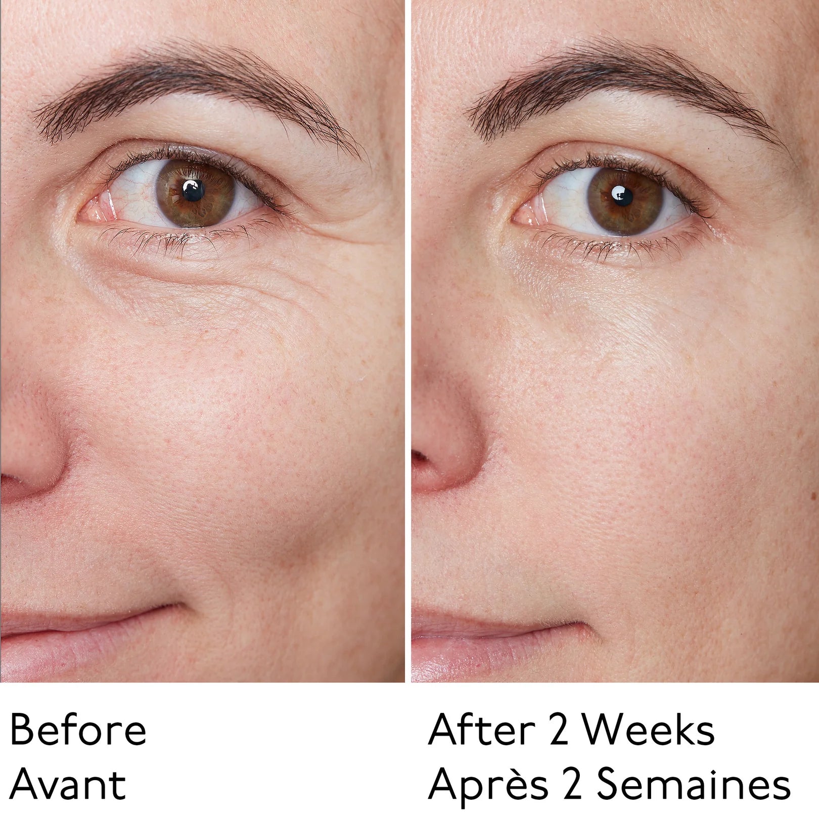 Hyaluronic Global Serum - Siero Idratante
