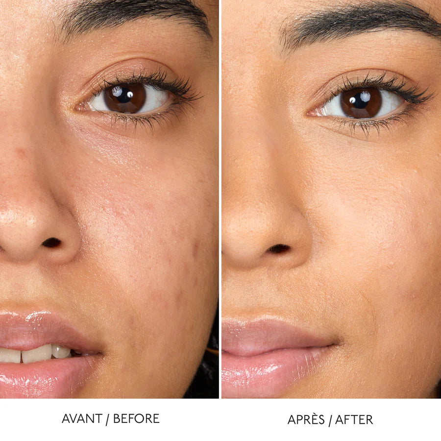 Hyaluronic Serum Concealer - Correttore idratante